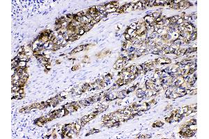 Immunohistochemistry (IHC) image for anti-Keratin 5 (KRT5) (AA 286-317), (Middle Region) antibody (ABIN4886654)