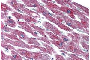 Immunohistochemistry (Formalin-fixed Paraffin-embedded Sections) (IHC (fp)) image for anti-Adenylate Cyclase Activating Polypeptide 1 (Pituitary) Receptor Type I (ADCYAP1R1) (N-Term) antibody (ABIN461703)