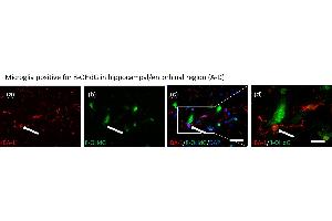 Very few IBA-1 positive dystrophic as well as ramified microglia (a), contained 8-OHdG (b) immune positive granules in their nuclei (hippocampal/entorhinal regions c, d). (8-OHDG antibody)