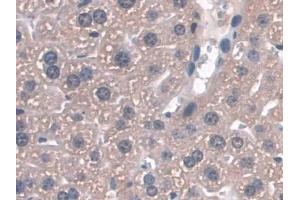 Detection of GPX3 in Mouse Liver Tissue using Polyclonal Antibody to Glutathione Peroxidase 3, Plasma (GPX3) (GPX3 antibody  (AA 3-72))