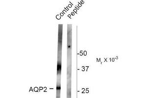 Image no. 1 for anti-Aquaporin 2 (Collecting Duct) (AQP2) (pSer261) antibody (ABIN372590)
