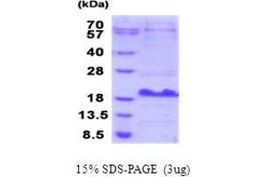 Small Breast Epithelial Mucin (SBEM) (AA 21-90) protein (His tag)