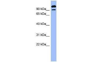 SCYL3 antibody used at 1 ug/ml to detect target protein. (SCYL3 antibody)