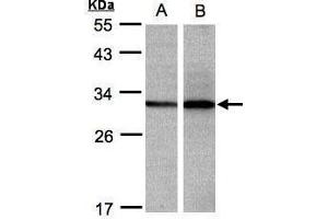 WB Image Sample(30 ug whole cell lysate) A: 293T B: H1299 12% SDS PAGE diluted at 1:500 (DCI antibody)