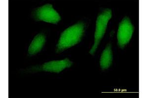 Immunofluorescence of purified MaxPab antibody to RNF34 on HeLa cell. (RNF34 antibody  (AA 1-373))