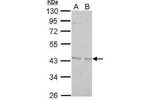 WB Image BRCC45 antibody detects BRE protein by Western blot analysis. (BRE antibody)