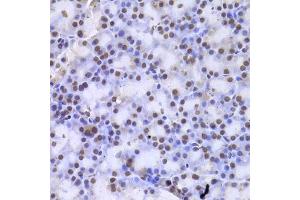 Immunohistochemistry of paraffin-embedded rat pancreas using CSNK1E Antibody. (CK1 epsilon antibody)