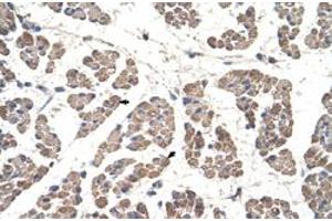 Immunohistochemical staining (Formalin-fixed paraffin-embedded sections) of human muscle with GCDH polyclonal antibody  at 4-8 ug/mL working concentration. (GCDH antibody  (C-Term))