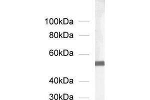dilution: 1 : 1000, sample: rat brain homogenate (alpha Tubulin antibody  (AA 419-435))