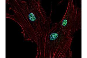 Immunofluorescence staining of p21 in human primary fibroblasts using anti-p21 (; green). (p21 antibody)