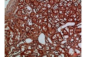Immunohistochemical analysis of paraffin-embedded Human-kidney, antibody was diluted at 1:100 (EYA1 antibody)