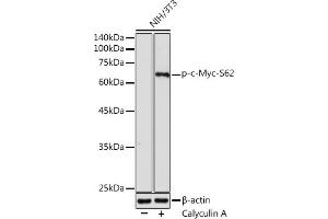 Western blot analysis of extracts of NIH/3T3 cells, using Phospho-c-Myc-S62 antibody (ABIN3019544, ABIN3019545, ABIN3019546 and ABIN6225456) at 1:1000 dilution.