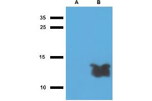 Western blotting analysis of polyclonal anti-Mycobacterium tuberculosis antigen Tb7. (Mycobacterium Tuberculosis Antigen Tb7.7 antibody)