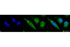 Immunocytochemistry/Immunofluorescence analysis using Rabbit Anti-GRP78 Polyclonal Antibody . (GRP78 antibody  (Biotin))