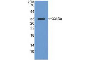 Western blot analysis of recombinant Human LAMa3. (LAMA3 antibody  (AA 47-296))