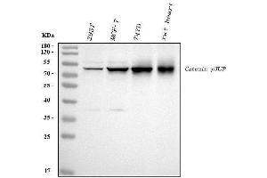 Western blot analysis of gamma Catenin using anti-gamma Catenin antibody (ABIN3043864). (JUP antibody  (AA 556-745))