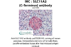 Image no. 1 for anti-Solute Carrier Family 11 (Proton-Coupled Divalent Metal Ion Transporters), Member 2 (SLC11A2) (C-Term) antibody (ABIN1739322) (SLC11A2 antibody  (C-Term))