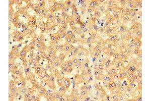 Immunohistochemistry of paraffin-embedded human liver tissue using ABIN7168546 at dilution of 1:100 (BHMT2 antibody  (AA 1-200))