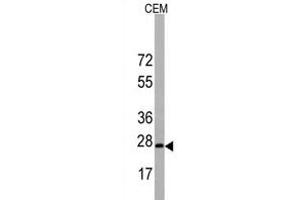 Western blot analysis of BarX1 Antibody (C-term) in CEM cell line lysates (35 μg/lane). (BARX1 antibody  (C-Term))