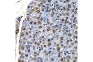 Immunohistochemistry of paraffin-embedded mouse pancreas using ID3 antibody at dilution of 1:200 (400x lens). (ID3 antibody)