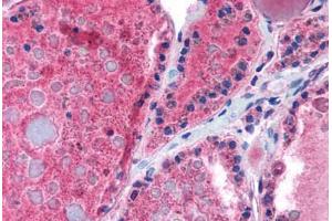 Thyroid (THRB antibody  (AA 37-86))