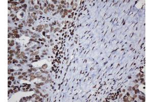 Image no. 1 for anti-Decapping Enzyme, Scavenger (DCPS) antibody (ABIN1497780) (DCPS antibody)