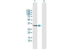 TP53I3 antibody  (AA 1-332)