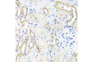Immunohistochemistry of paraffin-embedded rat kidney using BSND antibody. (BSND antibody)