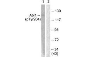 Western blot analysis of extracts from COS7 cells treated with Adriamycin 0. (ABL1 antibody  (pTyr204))