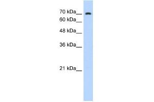WB Suggested Anti-ZNF441 Antibody Titration:  0.
