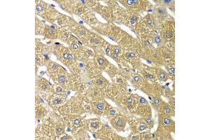 Immunohistochemistry of paraffin-embedded human liver injury using TMED10 Antibody (ABIN5974099) at dilution of 1/100 (40x lens). (TMED10 antibody)