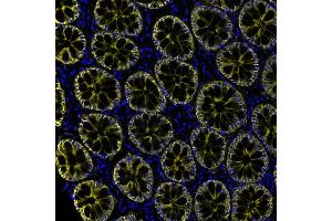 Immunofluorescence (IF) image for anti-Epithelial Cell Adhesion Molecule (EPCAM) (AA 264-314) antibody (ABIN7455204) (Recombinant EpCAM antibody  (AA 264-314))