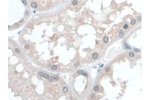 Immunohistochemistry (IHC) image for anti-Coenzyme Q6, Monooxygenase (COQ6) (AA 1-468) antibody (ABIN7444298)