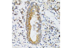 Immunohistochemistry of paraffin-embedded human vermiform appendix using SRP19 antibody (ABIN2560139) at dilution of 1:100 (40x lens). (SRP19 antibody)