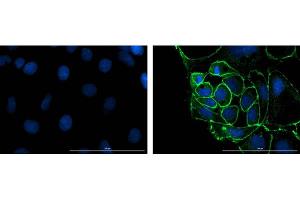 Immunofluorescence microscopy using Fluorescent anti-rabbit IgG. (Fluorescent TrueBlot®: Anti-Rabbit IgG Fluorescein)