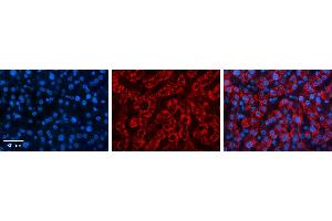USE1 antibody - middle region          Formalin Fixed Paraffin Embedded Tissue:  Human Liver Tissue    Observed Staining:  Cytoplasm in hepatocytes   Primary Antibody Concentration:  1:100    Secondary Antibody:  Donkey anti-Rabbit-Cy3    Secondary Antibody Concentration:  1:200    Magnification:  20X    Exposure Time:  0. (UBE2Z antibody  (Middle Region))