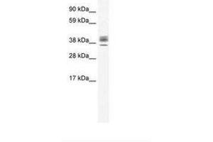 Image no. 1 for anti-ESX Homeobox 1 (ESX1) (N-Term) antibody (ABIN202219) (ESX Homeobox 1 antibody  (N-Term))