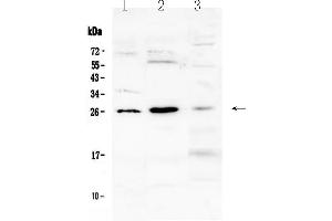 Western blot analysis of Flt3 ligand using anti-Flt3 ligand antibody . (FLT3LG antibody  (AA 28-189))