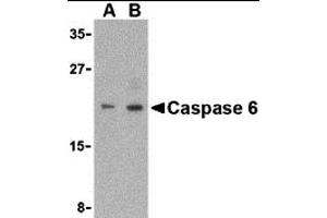 Western Blotting (WB) image for anti-Caspase 6, Apoptosis-Related Cysteine Peptidase (CASP6) (Middle Region) antibody (ABIN1030902) (Caspase 6 antibody  (Middle Region))