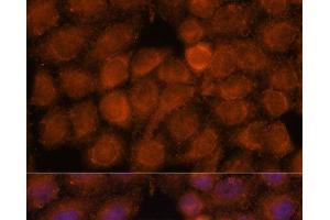 Immunofluorescence analysis of HeLa cells using NDUFAF4 Polyclonal Antibody at dilution of 1:100. (NDUFAF4 antibody)