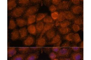 Immunofluorescence analysis of HeLa cells using NDUFAF4 Polyclonal Antibody at dilution of 1:100. (NDUFAF4 antibody)
