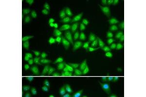 Immunofluorescence analysis of HeLa cells using CHD2 Polyclonal Antibody (CHD2 antibody)