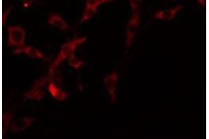 ABIN6275209 staining COLO205 by IF/ICC. (Lipase I antibody  (Internal Region))