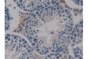 Detection of Flt3 in Mouse Testis Tissue using Polyclonal Antibody to FMS Like Tyrosine Kinase 3 (Flt3) (FLT3 antibody  (AA 335-544))