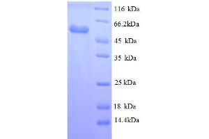 SDS-PAGE (SDS) image for Vimentin (VIM) (AA 2-466) protein (His tag) (ABIN7478956)