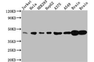 Western Blot Positive WB detected in: Jurkat whole cell lysate, Hela whole cell lysate, HEK293 whole cell lysate, HepG2 whole cell lysate, A375 whole cell lysate, A549 whole cell lysate, Rat Brain whole cell lysate, Mouse Brain whole cell lysate All lanes: ERK2 antibody at 1:1000 Secondary Goat polyclonal to rabbit IgG at 1/50000 dilution Predicted band size: 42, 37 kDa Observed band size: 42 kDa (Recombinant ERK2 antibody)