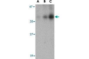 Western blot analysis of DFFB in Jurkat cell lysate with DFFB polyclonal antibody  at (A) 0. (DFFB antibody  (AA 203-218))