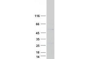Western Blotting (WB) image for Sorting Nexin 32 (SNX32) protein (Myc-DYKDDDDK Tag) (ABIN2732405)