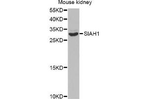 Western blot analysis of extracts of mouse kidney, using SIAH1 antibody (ABIN5971329) at 1/1000 dilution. (SIAH1 antibody)