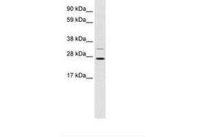 Image no. 1 for anti-DNA repair and recombination protein RAD54B (RAD54B) (AA 76-125) antibody (ABIN202190) (RAD54B antibody  (AA 76-125))